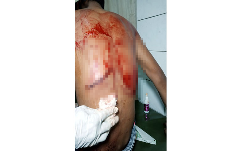 সিদ্ধিরগঞ্জে কিশোর গ্যাংয়ের উৎপাত, চাপাতির কোপ স্কুলছাত্রের গায়ে