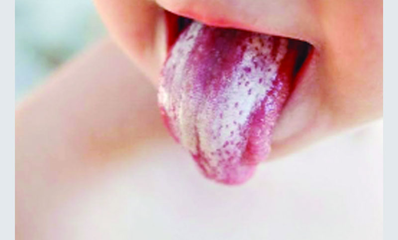 Kokraklar va mushuklar