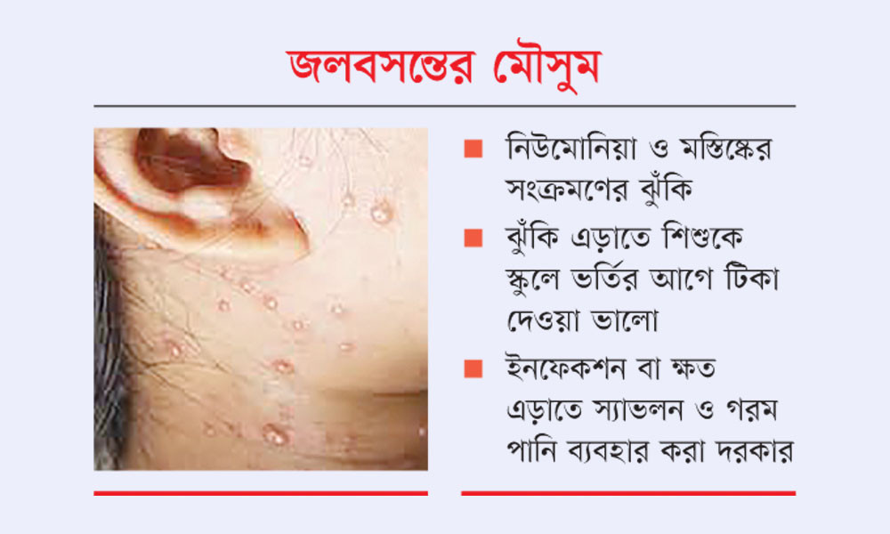 সংক্রামক ব্যাধি হাসপাতালে ভর্তি রোগীর ৭৮% শিশু