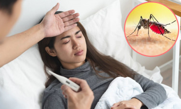 জ্বরে ডেঙ্গু হয়েছে কি না বুঝবেন যেভাবে