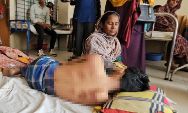 ইফতারের ফল খাওয়ায় মাদরাসাছাত্রকে নির্যাতনের অভিযোগ