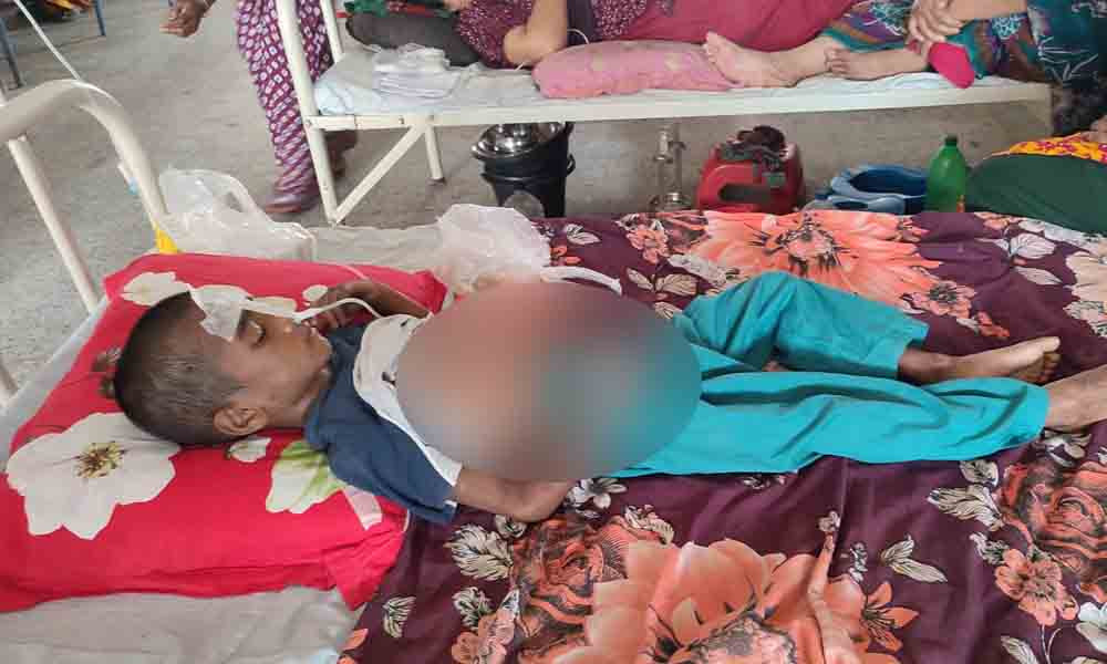 শিশু সোয়াইবের শরীর জুড়ে সিগারেটের ছ্যাকা, করানো হত ভিক্ষা