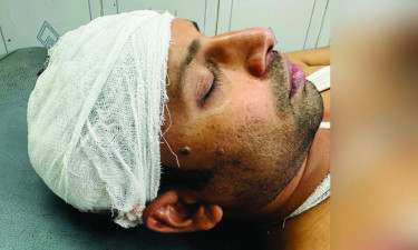 স্বেচ্ছাসেবক লীগ নেতার নেতৃত্বে সাংবাদিককে পিটিয়ে জখম, মাথায় ৬ সেলাই