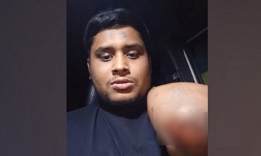 কোথায় গিয়েছিলেন হাসনাত, কেন হলো হামলা? (ভিডিওসহ)