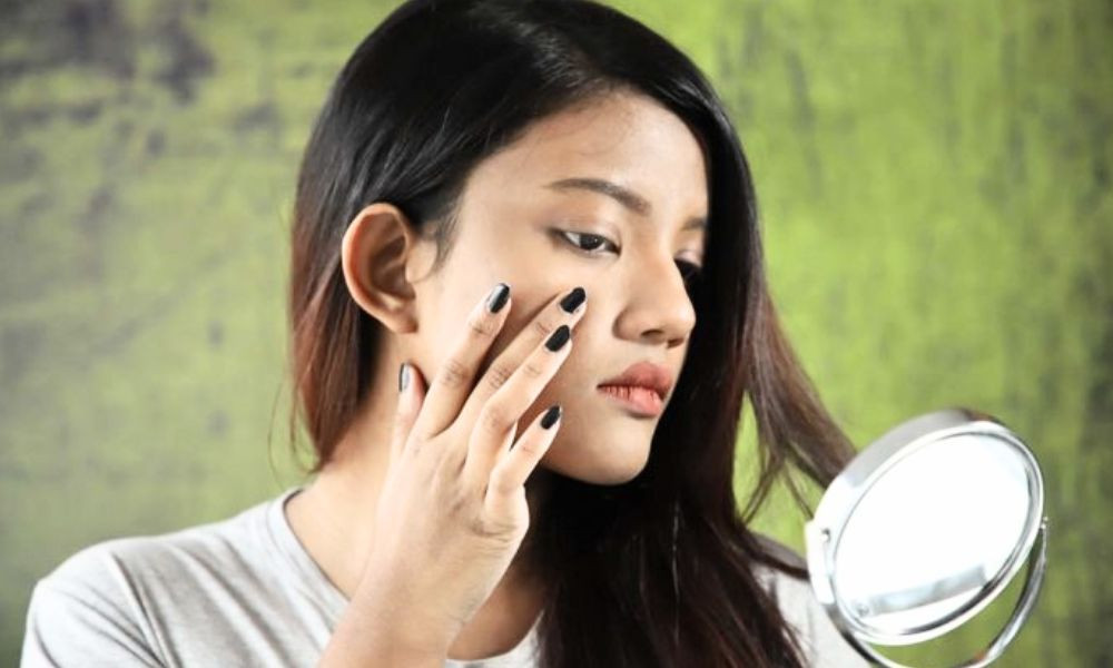 কিশোর বয়সে মুখে ব্রণ বেশি হয় কেন, যা বলছে গবেষণা