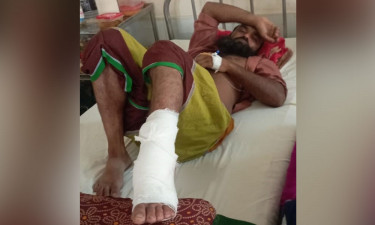 পুকুর খননে বাধা, ভেকুর আঘাতে ভ্যানচালকের পা বিচ্ছিন্ন