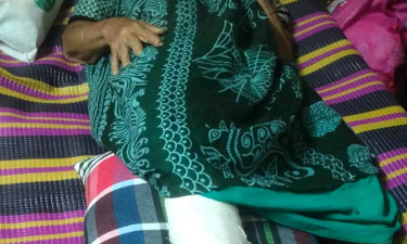 মাকে পিটিয়ে পা ভেঙে দিলেন ছেলে