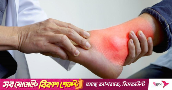 Erlar xotinlarini jinsiy aloqa uchun almashtirdilar Nastya Volochkovaning samimiy fotosuratlari