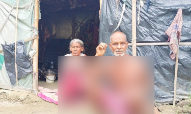 ঝুপড়ি ঘরে বৃদ্ধ দম্পতির মানবেতর জীবন