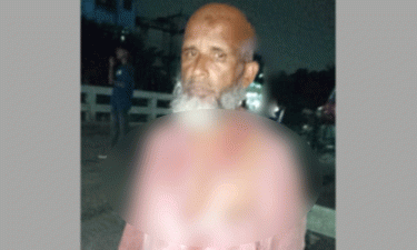 দলীয় ব্যানার লাগাতে গিয়ে হামলার শিকার জামায়াত নেতা