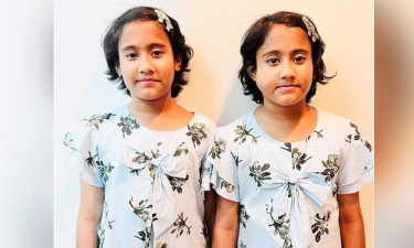 কুমিল্লার যমজ বোনের স্বাস্থ্যের অবনতি, দোয়া চাইলেন মা-বাবা