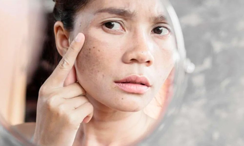 ত্বক কালো হতে শুরু করে যে ভিটামিনের অভাবে