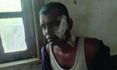 পাবনায় কৃষককে কুপিয়ে হত্যাচেষ্টার অভিযোগ, অতঃপর ...
