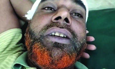 নাটোরে দুই পাট ব্যবসায়ীকে পিটিয়ে ৫ লক্ষাধিক টাকা ছিনতাই