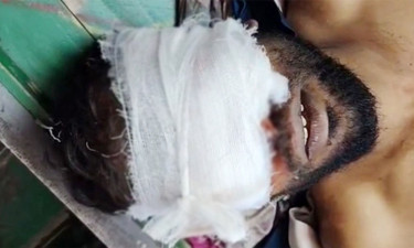 হাত-পা ভাঙার পর অটোচালকের দুচোখ উপড়ে ফেলার অভিযোগ
