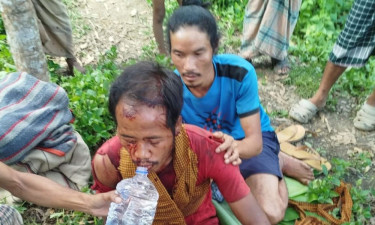 রুমার পাহাড়ে বন্য ভাল্লুকের থাবায় জুমিয়া কৃষক গুরুতর আহত