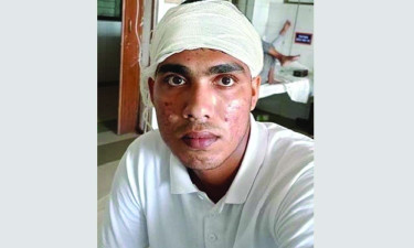 পাখি শিকারের প্রতিবাদ করায় যুবকের কপালে গুলি, মামলা