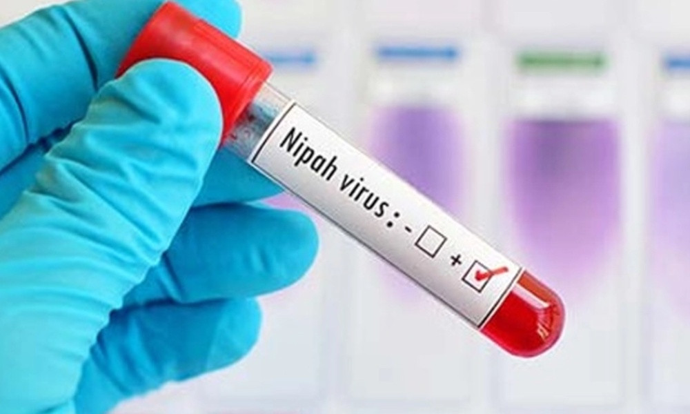 ৩৫ জেলায় নিপাহ ভাইরাস শনাক্ত, হাসপাতালগুলোকে প্রস্তুত থাকার নির্দেশ