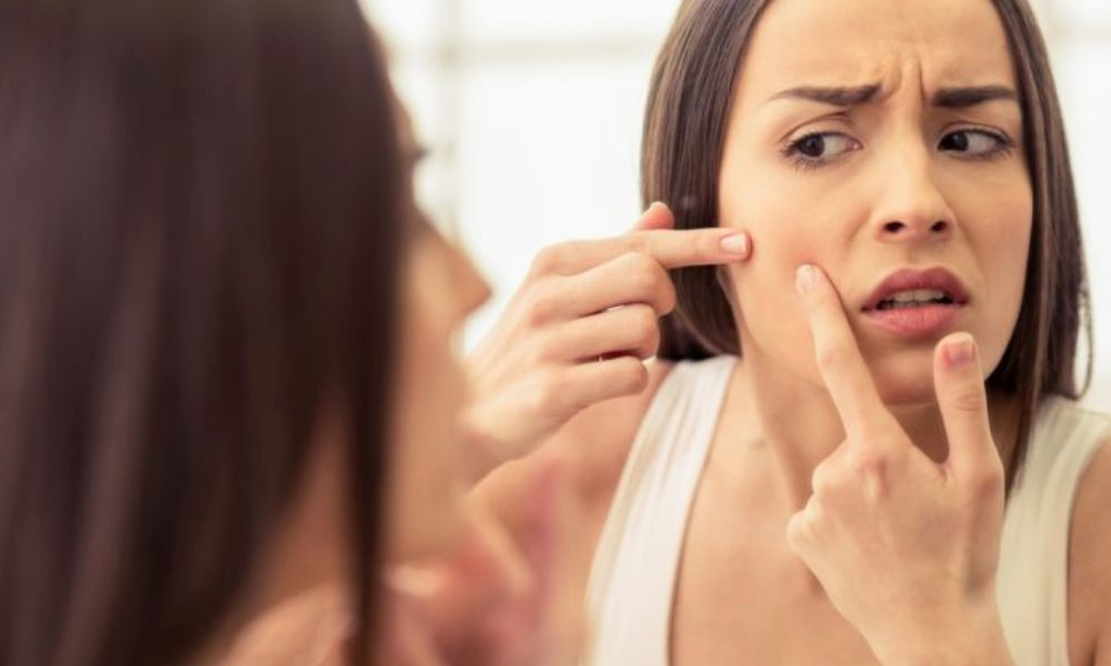 কোন ভিটামিনের অভাবে মুখে ব্রণ বাড়ে? সমাধান কিসে