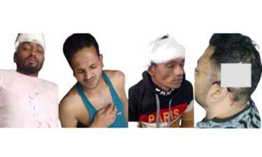 চট্টগ্রামে বিএনপি-জামায়াত সংঘর্ষে আহত ১৬