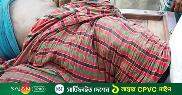 চুরির দায়ে যুবকের চোখ উপড়ে ফেলার অভিযোগ