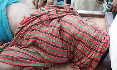 চুরির দায়ে যুবকের চোখ উপড়ে ফেলার অভিযোগ