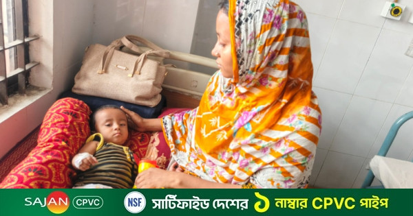 হাম উপসর্গে হাসপাতালে ১৯৩ শিশু, শনাক্ত ৫