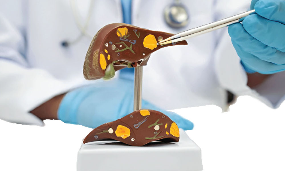 লিভারের যত রোগ