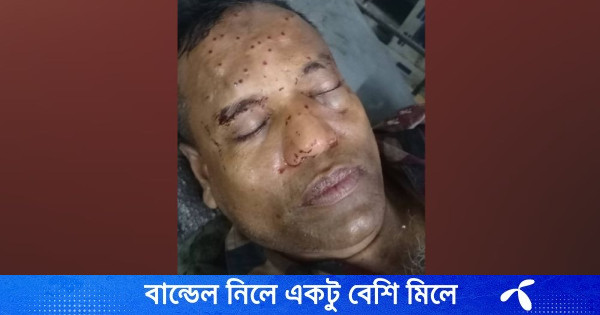 হরিপুর সীমান্তে বিএসএফের গুলিতে বিজিবি সদস্য আহত