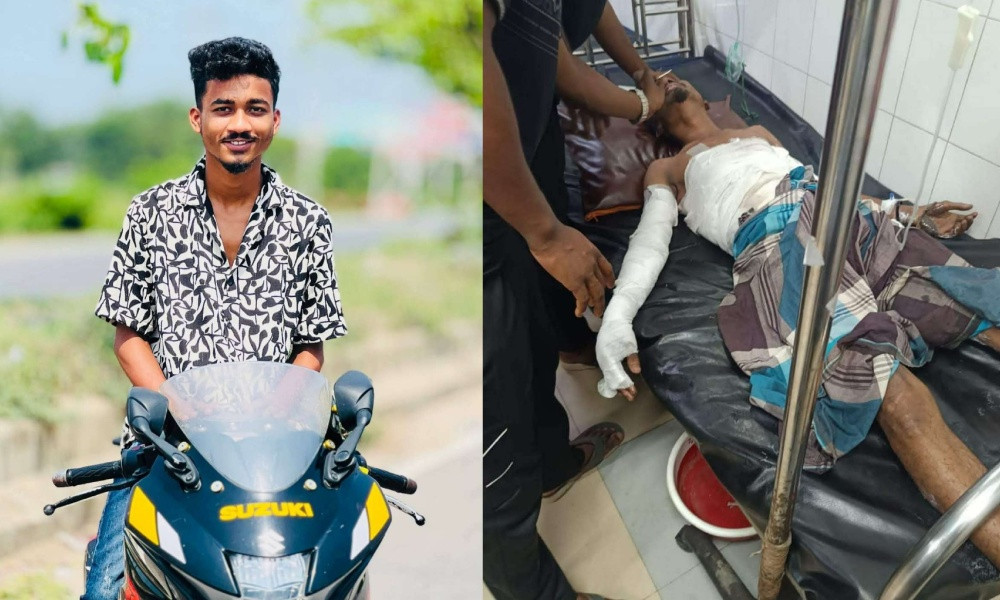 বুড়িচংয়ে প্লাস্টিক কারখানায় অগ্নিকাণ্ডে দগ্ধ যুবকের মৃত্যু