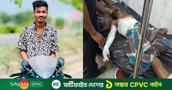বুড়িচংয়ে প্লাস্টিক কারখানায় অগ্নিকাণ্ডে দগ্ধ যুবকের মৃত্যু