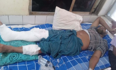 ফরিদপুরে ব্যবসায়ীকে কুপিয়ে জখম, তিন লাখ টাকা ছিনতাই