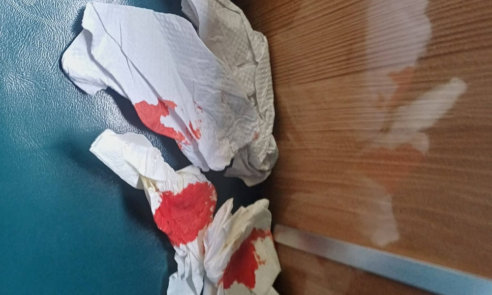 চবির শাটল ট্রেনে পাথর নিক্ষেপে ছাত্রী আহত