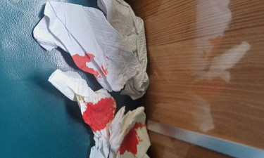 চবির শাটল ট্রেনে পাথর নিক্ষেপে ছাত্রী আহত