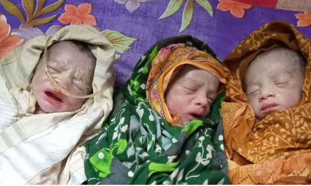 লালপুরে একসঙ্গে তিন সন্তানের জন্ম