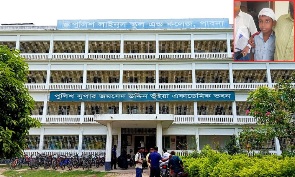 ক্লাস চলাকালীন ফ্যান মাথার ওপর পড়ে স্কুলশিক্ষার্থী আহত