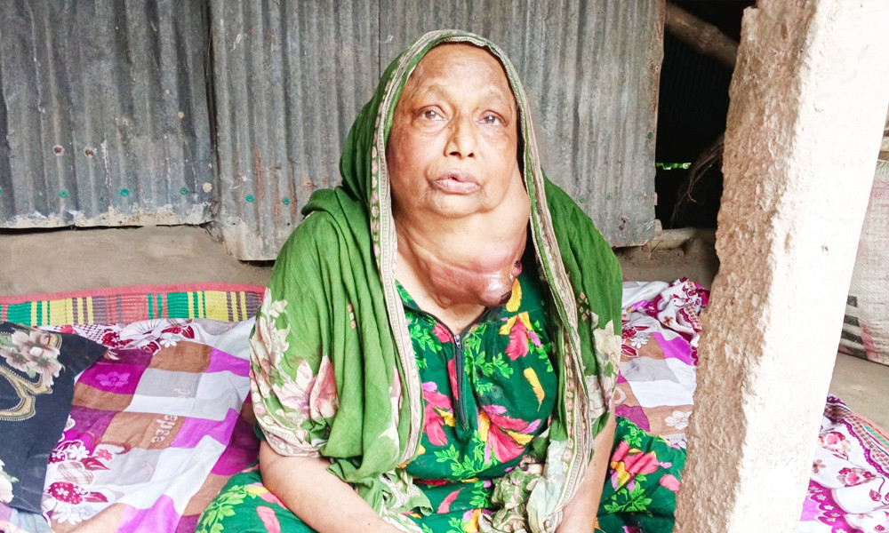 ‘মাকে আপনারা বাঁচান, মা ছাড়া আমার কেউ নেই’