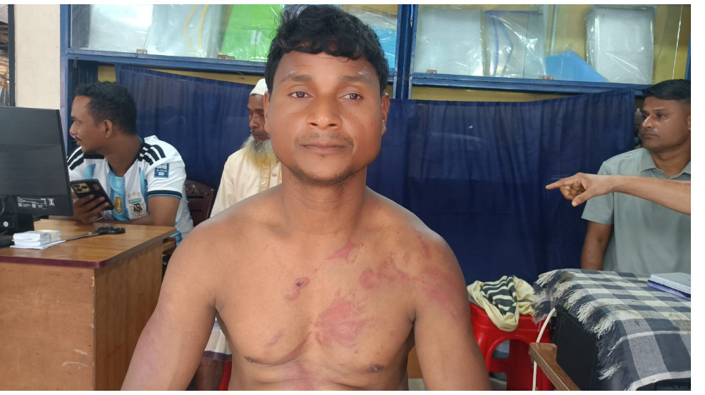 টেকনাফে দুই নাইট গার্ড অপহরণ, বেধড়ক মারধরের অভিযোগ