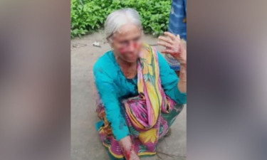 কুড়িগ্রামে শিয়ালের আক্রমণে দুই নারী আহত, এলাকাজুড়ে আতঙ্ক