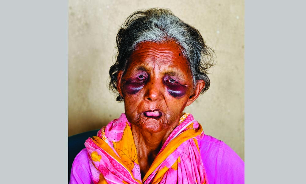 দুর্বৃত্তের হামলায় নিভে গেল সেই বাকপ্রতিবন্ধী পরিচ্ছন্নতা কর্মী ববির জীবন