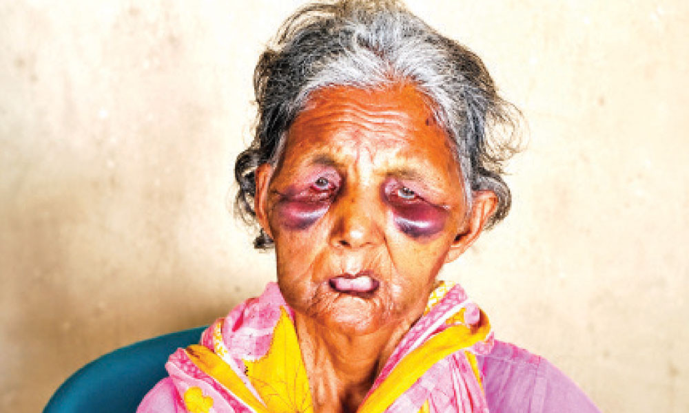 হামলায় আহত সেই প্রতিবন্ধী পরিচ্ছন্নতা কর্মীর মৃত্যু