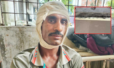 হাসপাতালের ছাদের পলেস্তারা খসে পড়ে রোগীর বাবা আহত