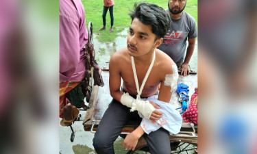 পরীক্ষা দিতে যাচ্ছিল সিয়াম, মাস্ক পরে মোটরসাইকেলে এসে ছুরিকাঘাত