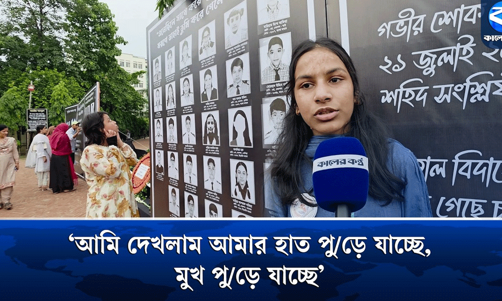 ‘আমি দেখলাম আমার হাত পুড়ে যাচ্ছে, মুখ পুড়ে যাচ্ছে’